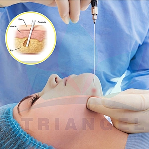 Non Invasive Therapy Body Slimming Lipo Fat Removal Diode Laser Machine 980nm1470nm