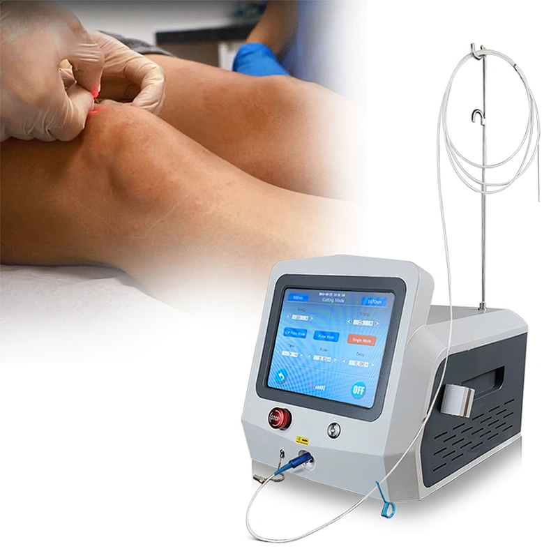 Hot Sale EVLT Diode Laser Spider Vein Removal Machine 980nm 1470nm Laser for Vascular Lesion Removal