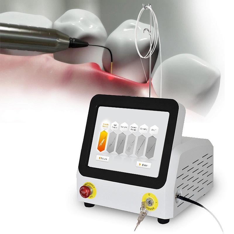 Dental Diode Laser Soft Tissue Laser Melting 980nm Dentale Gingivectomy Fiber Laser Equipment