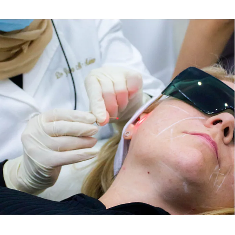 Multifunction Surgical Lipolysis 980nm 1470nm  Laser Liposuction