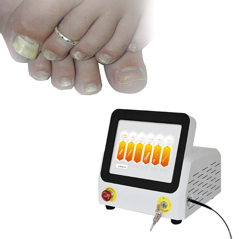 Class IV 980nm Fungus Nail Removal Diode Laser Machine Treatment Podiatry Nail Fungus Onychomycosis