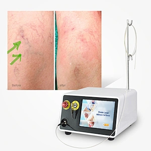High Power Diode Laser 980nm 1470nm Surgical Varicose Veins EVLT Minimally Invasive Laser Device