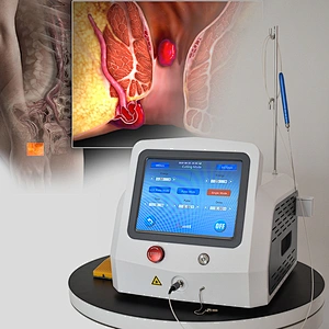 Proctological Surgery 980nm 1470nm Laser Machine Hemorrhoids  Laser Treatment  Diode Laser Machine