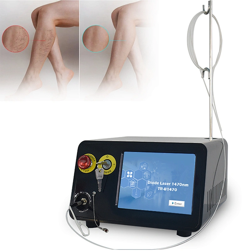 Diode Laser Ablation EVLT1470nm Endovenous Laser Varicose Vein Treatment Device/Spider Veins Vascular Removal Machine