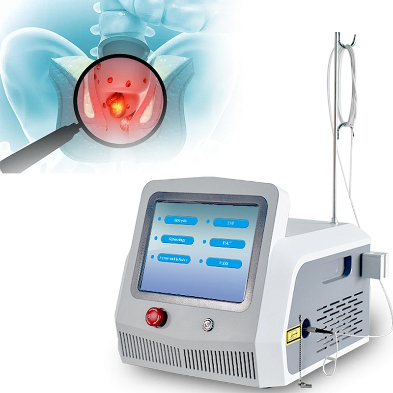 Hemorrhoids Treatment Surgery Laser Diode 980nm+1470nm Removal Piles  Hemorrhoids Anal Fistula Proctology  Laser Device