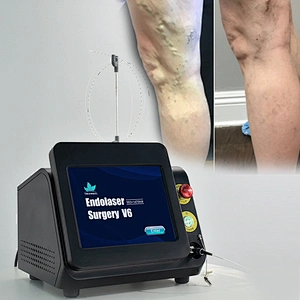 47W Diode Laser 980nm 1470nm Laser Para Varices EVLT Endo Varicose Veins Treatment Machine for Clinic