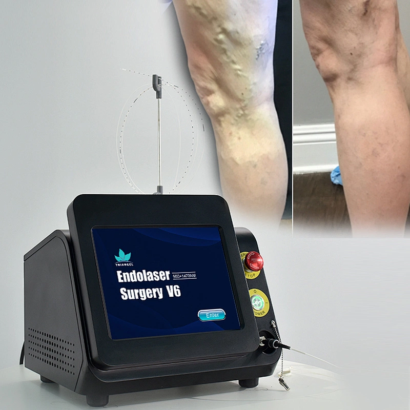 47W Diode Laser 980nm 1470nm Laser Para Varices EVLT Endo Varicose Veins Treatment Machine for Clinic