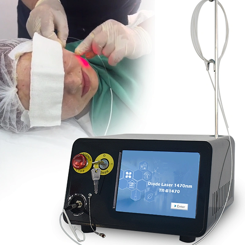 Best Price 1470nm  Fiber Lift Laser Lipolysis  No Pain No Bleeding Face Lifting Skin Tightening
