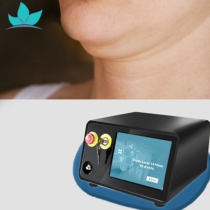 Fiber Laser 1470nm Lipo Laser Machine Liposuction Lipolysis 1470nm Skin Rejuvenation Laser Beauty Device