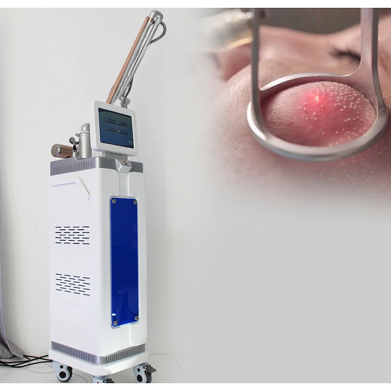 2024 Hot Sale 3 in 1 Skin Rejuvenation  Scar Revmoval Vaginal Laser Tightening  Face Lifting Equipment Tube Laser