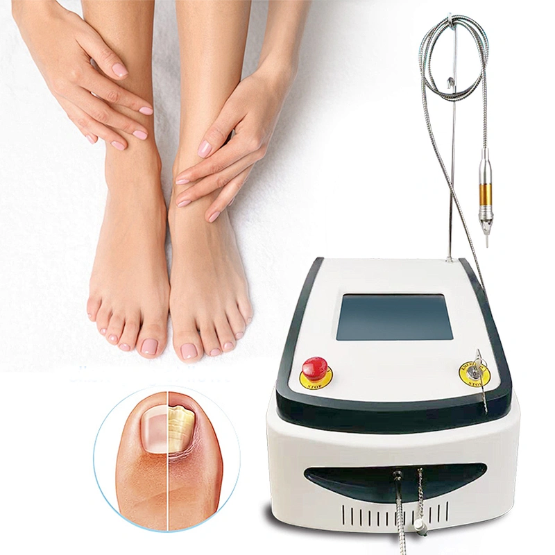 980nm Nail Fungus Diode Laser Machine Treatment Onychomycosis Nail Fungus Podiatry Plantar Warts Onychomycosis