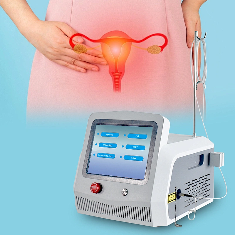 Gynecological 980 1470nm Minimally Invasive Laser Therapy Ovarian Endometriosis Adhesiolyses