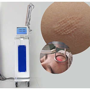 2024 Hot Sale 3 in 1 Skin Rejuvenation  Scar Revmoval Vaginal Laser Tightening  Face Lifting Equipment Tube Laser