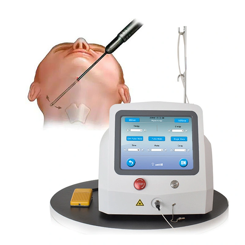 Effective Result Laser Lipolysis Liposuction Machine Plastic Surgery 1470 nm 980 nm Endofiber Laser