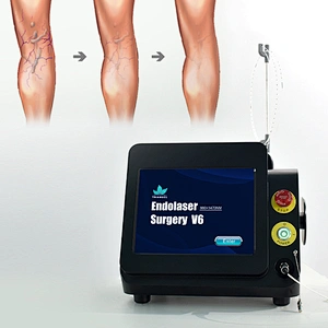 Dual Wave 980nm Class Iv Surgical Laser Equipment for Varices Des Membres Inferieurs Varicose Veins Evlt  Evla Varice