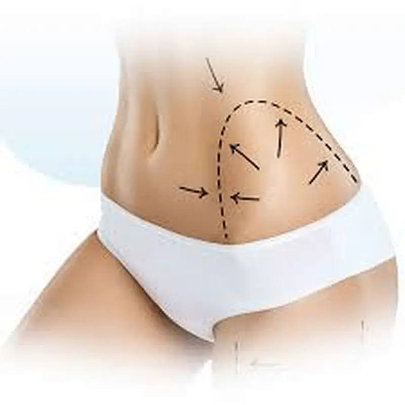 Best Sale 980nm 1470nm  Laser Lipolysis Laser Device  Liposuction Machine