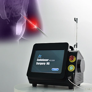 980nm1470nm Minimally Invasive Proctology Treatment Device Diode Laser Removal Hemorrhoids & Anal Fistula