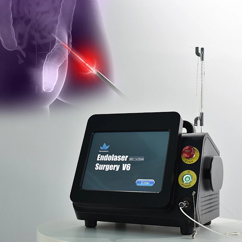 980nm1470nm Minimally Invasive Proctology Treatment Device Diode Laser Removal Hemorrhoids & Anal Fistula