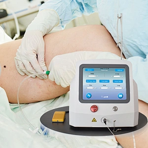 Endolaser Dual Wave 980 1210 1470 Nm Lipo Diode Laser Face Lifting Endolasermachine Fibra 400 600 800