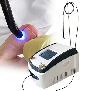 980nm Nail Fungus Diode Laser Machine Treatment Onychomycosis Nail Fungus Podiatry Plantar Warts Onychomycosis