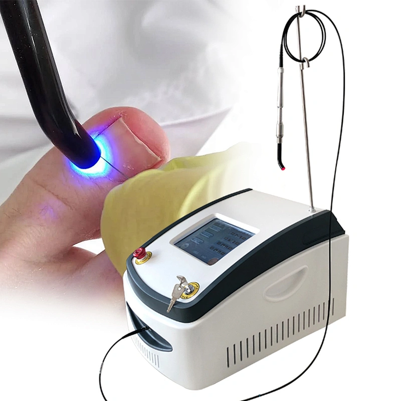 980nm Nail Fungus Diode Laser Machine Treatment Onychomycosis Nail Fungus Podiatry Plantar Warts Onychomycosis