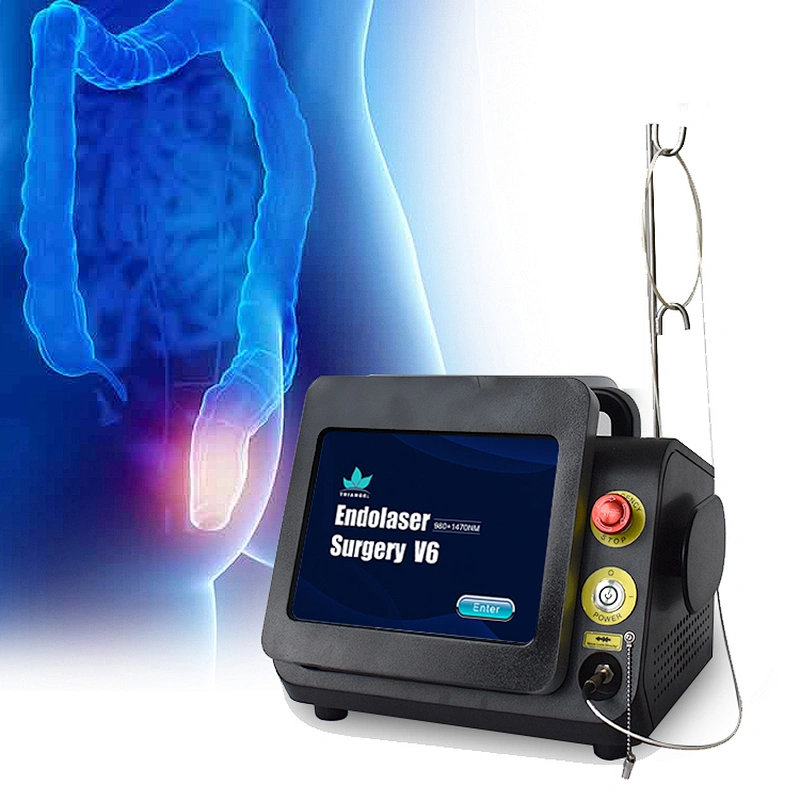 980nm 1470nm  Hemorrhoid Removal Laser  Machine Anal Fistula Haemorrhoids Laser Treatment