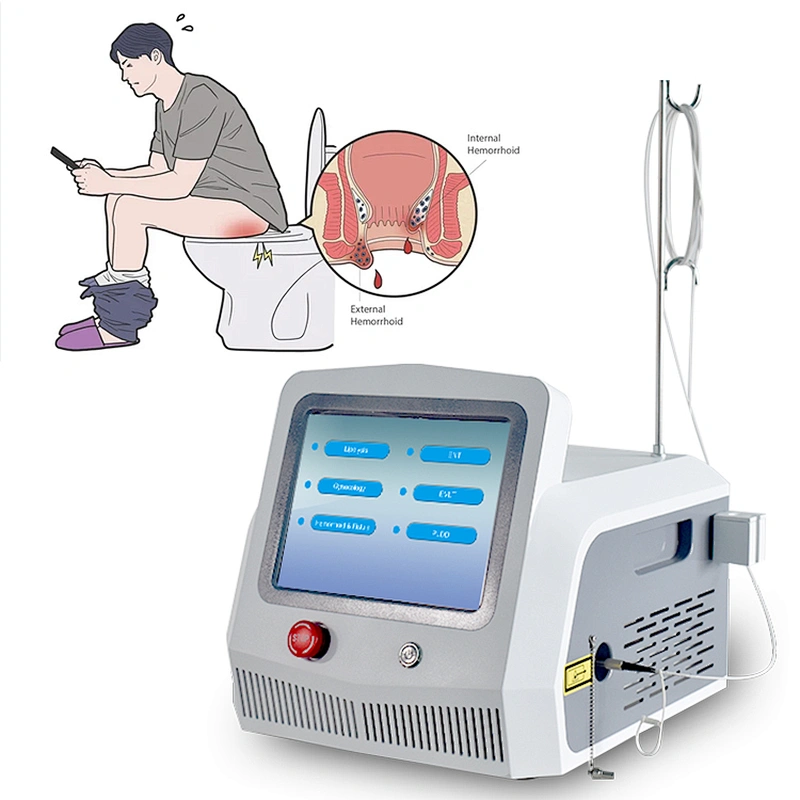 Hemorrhoids Diode Laser Instrument Treatment Device 1470nm Removal Anal Fistula Hemorrhoids 980nm Diode Laser