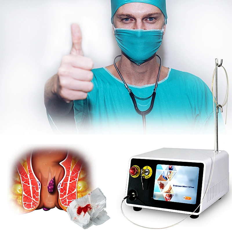 Hemorrhoids Treatment Surgery Diode Laser 1470nm With CE Hemorrhoids Laser Anal Fistula Hemorrhoids 980nm Laser