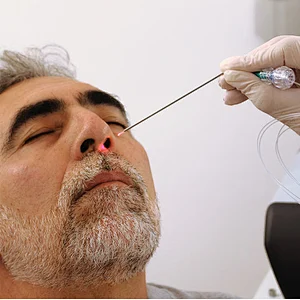 Tazlaser New Design Diode Laser 980nm+1470nm ENT Otolaryngology Surgical Treatment Equipment