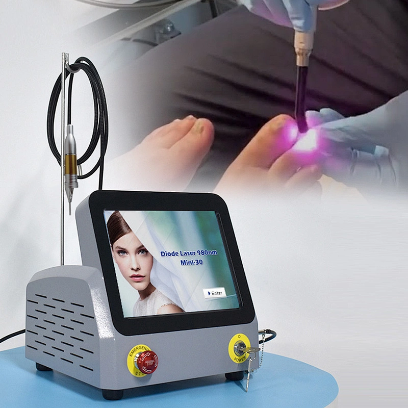 2025 Triangel Hot Sale 30w Podiatry Laser Treatment Machine 980nm Diode Laser Nail Fungus Treatment Device