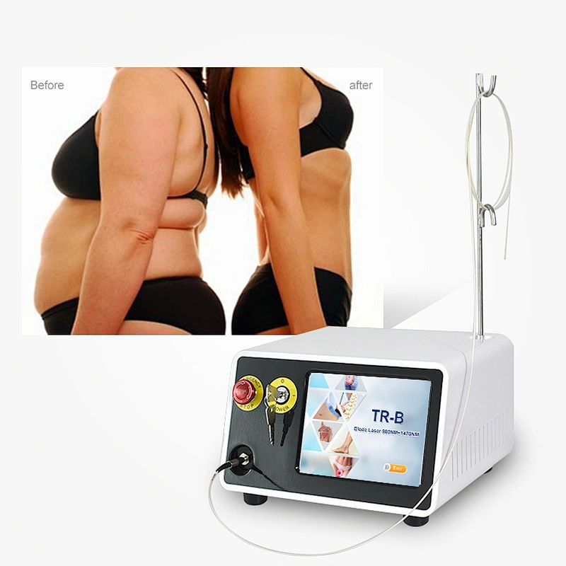 Newest High Power  980nm 1470nm Diode Laser Liposuction / Lipolysis Facelifting Laser Machine