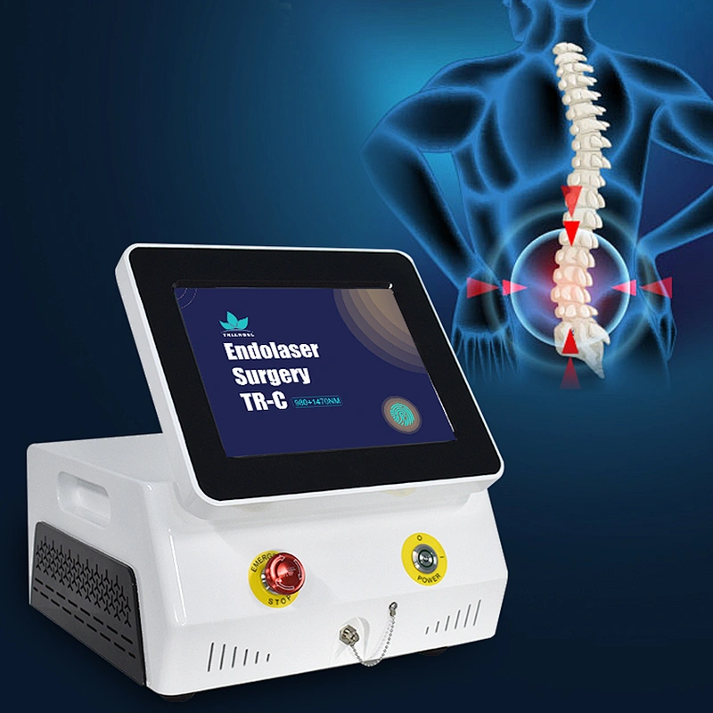 2024 Innovative Portable Diode 980 1470 nm Laser for PLDD Laser Treatment