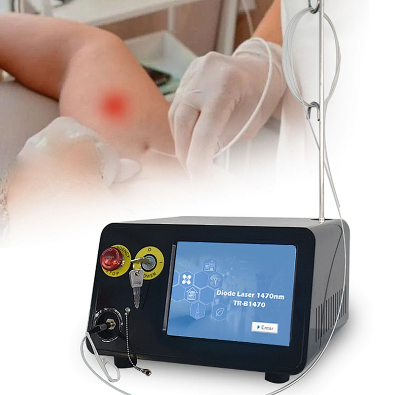 Endo Laser Diodo  Lipo Laser Machine 1470 Lipolysis Laser Fibra Endolaser Lipolise Lift