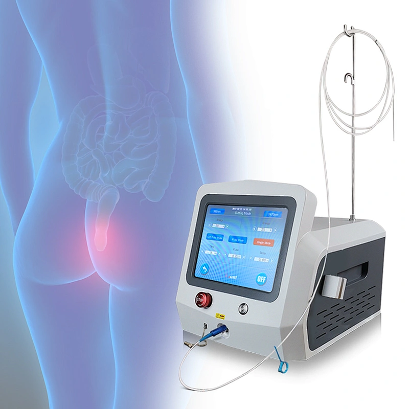 Newest Proctology Laser Surgery Diode Laser 1470 Nm Instruments for Proctology Aesthetic Diode Laser