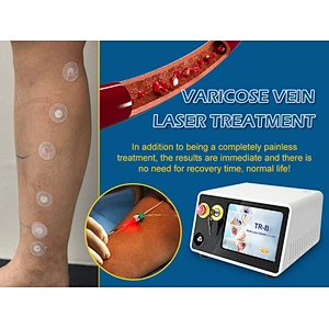Triangel 1470nm Varicose Veins Laser EVLT EVLA Laser Machine