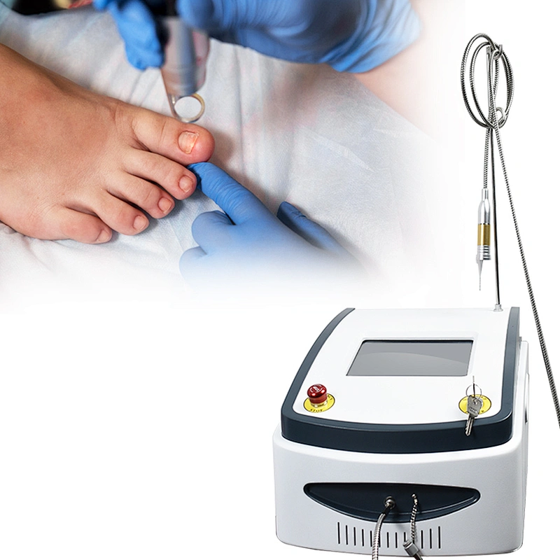 2024 New Product 980nm Onychomycosis Diode Laser Anti Fungus Nail Treatment for Podiatry