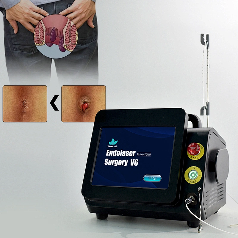 Hot Sale 980nm 1470nm Diode Laser Treatment Hemorrhoid Laser Ablation Proctology Surgical Laser Machine