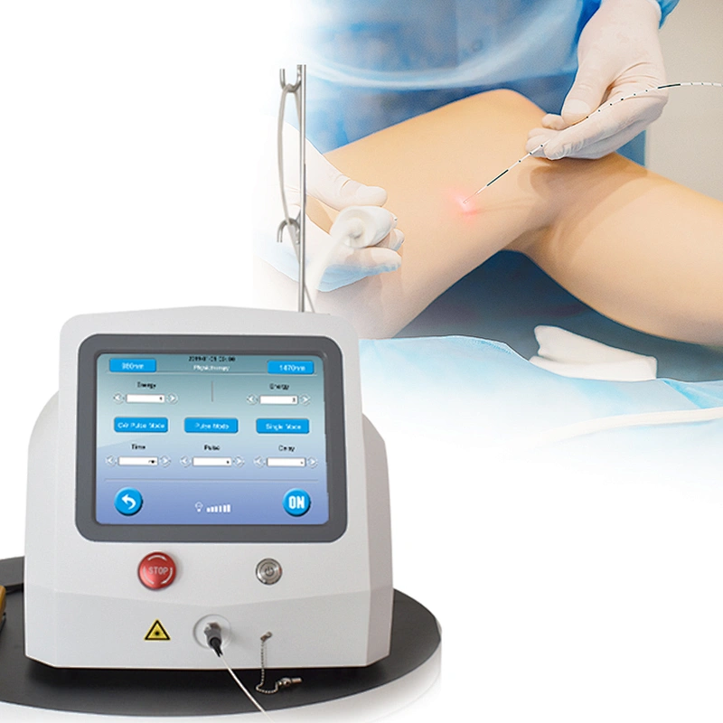 EVLT Varicose Vein Laser Treatment 1470nm 980nm Diode Laser Fiber Transfer Mini Invasive Endovascular Surgery Beauty Equipment