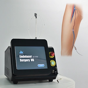 Portable Dual Wave 980nm+1470nm Diode Laser  Equipment Removal Varicose Veins EVLT EVLA