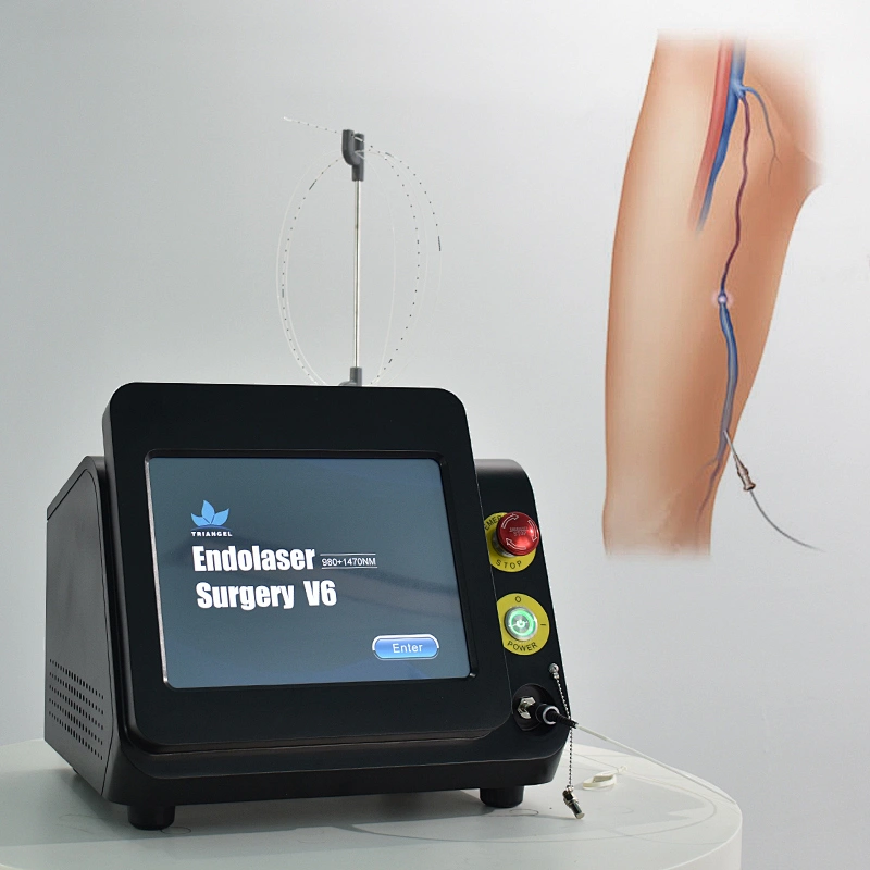 Portable Dual Wave 980nm+1470nm Diode Laser  Equipment Removal Varicose Veins EVLT EVLA