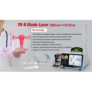 1470nm Laser Gynecology Laser Vaginal Atrophy Uterine Fibroids  Ovarian Fibroids Treatment Laser Machine