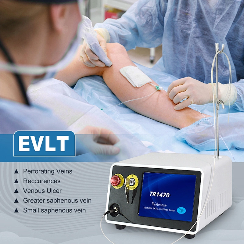 Intravenous Laser Ablation Laser EVLT EVLA  Leg Varicose Veins 1470nm  Laser Machine
