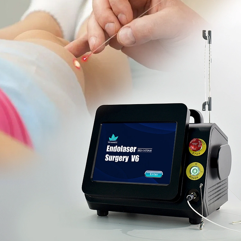 Spider Vein Telangiectasis Varicose Lesion Removal Laser Machine 980nm 1470nm Wavelength