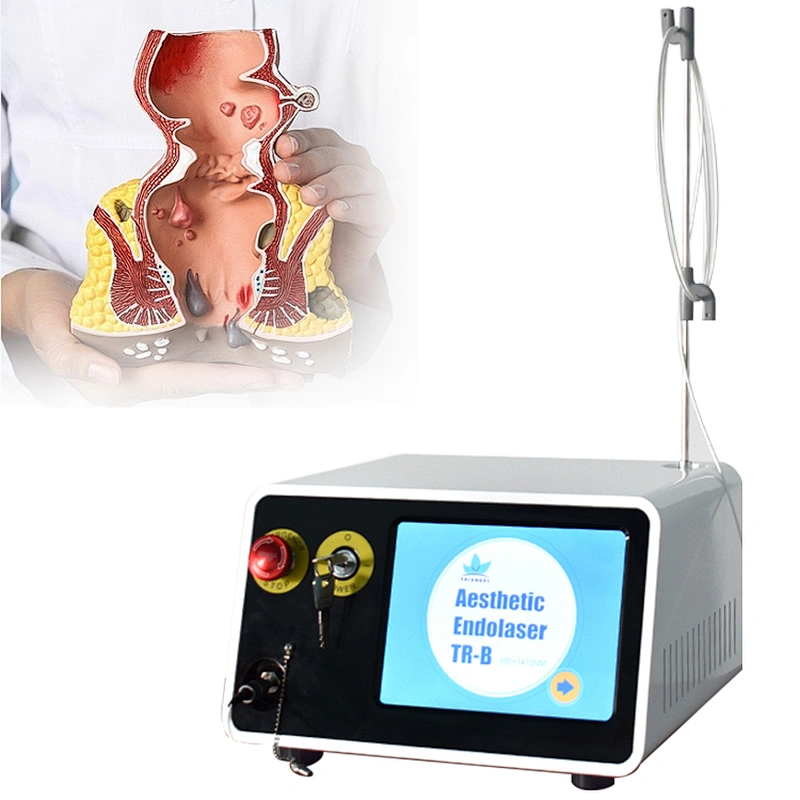 TRIANGEL Diode Laser 980nm1470nm Hemorrhoids Surgical Removal Device for Pilonidal Sinus/Hemorrhoids Treatment