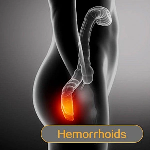 980nm 1470nm Hemorrhoidsurgery Haemorrhoids  Piles Fissure and Fistula Laser Machine
