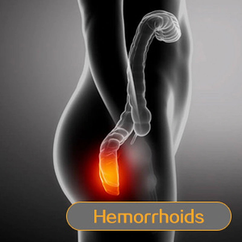 980nm 1470nm Hemorrhoidsurgery Haemorrhoids  Piles Fissure and Fistula Laser Machine