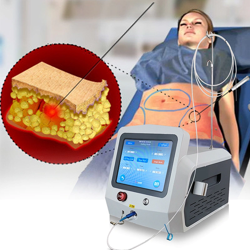 Aesthetic Medicine Laser 980nm Liposuction Device Vaser Fat Removal Lipomas Beauty Machine Liposuction Surgery Laser