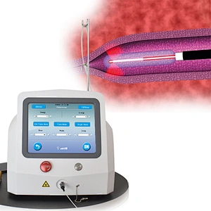 Minimally Invasive EVLT  Varicose Veins Laser 1470 nm  Ablation Therapy  Endovenous EndoLaser Vein Surgery Laser 1470nm