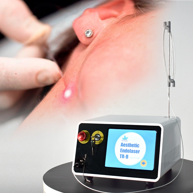 980nm Diode Laser Lipolysis 47w Weight Loss Liposuction Endolaser Face and Neck Lift Machine Endolifting Laser
