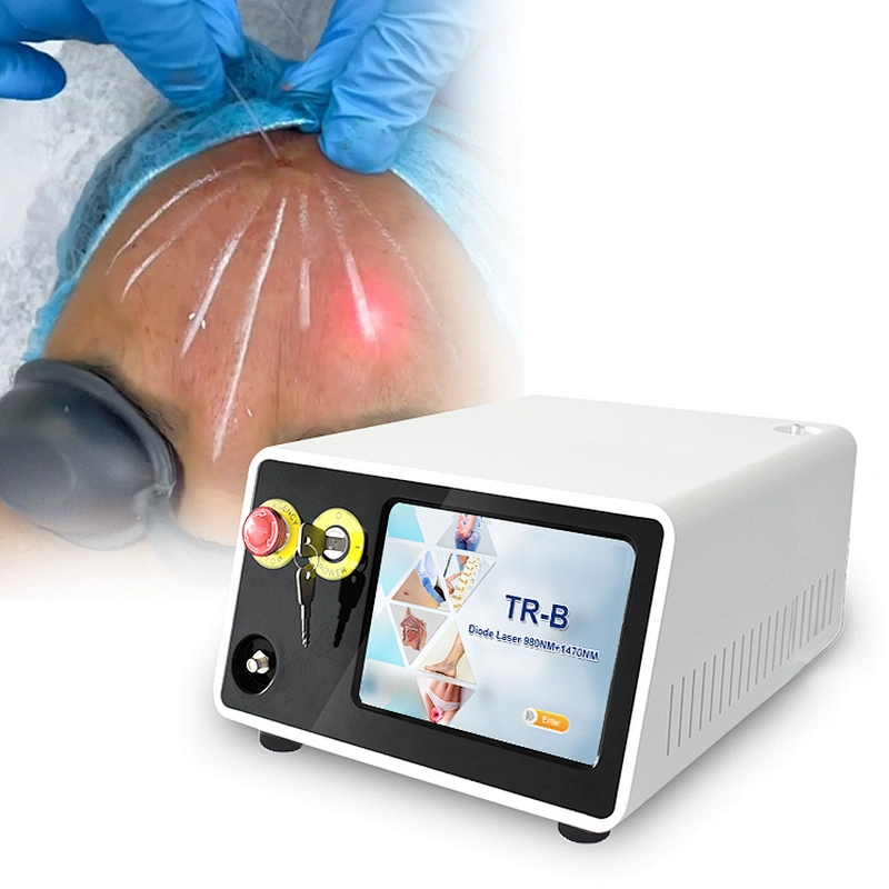 1470nm 980nm Diode Laser Lipolysis Liposuction Machine Plastic Surgery Face Lift Machine